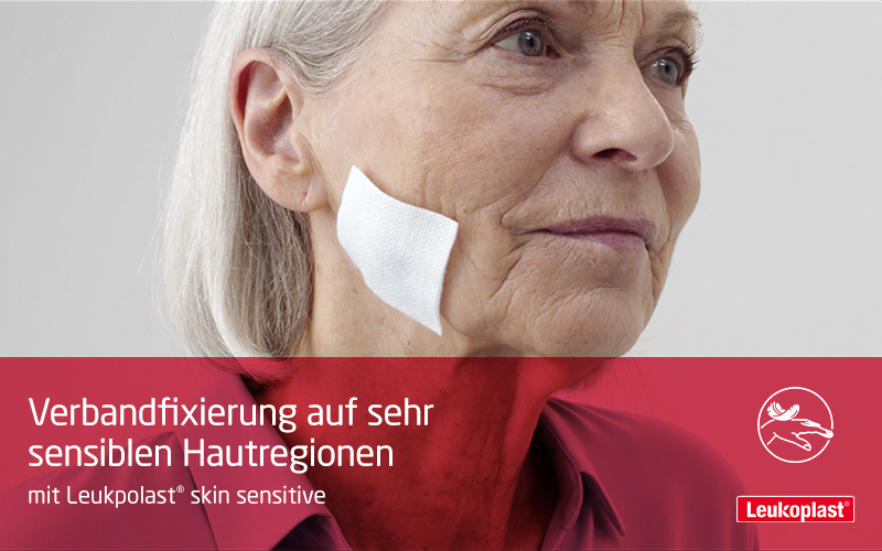 Hier sehen Sie, wie die Verbandfixierung auf sehr sensiblen Hautregionen appliziert und repositioniert wird: Das Fachpersonal befestigt ein Wundpad auf der Wange einer älteren Patientin mit Leukpolast® skin sensitive. Hier sehen Sie, wie die Verbandfixierung auf sehr sensiblen Hautregionen appliziert und repositioniert wird: Das Fachpersonal befestigt ein Wundpad auf der Wange einer älteren Patientin mit Leukpolast® skin sensitive.